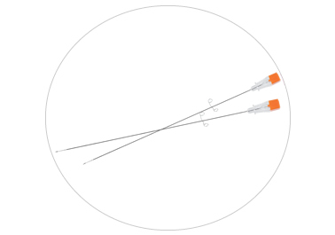 M-Drain Drainage Catheter
